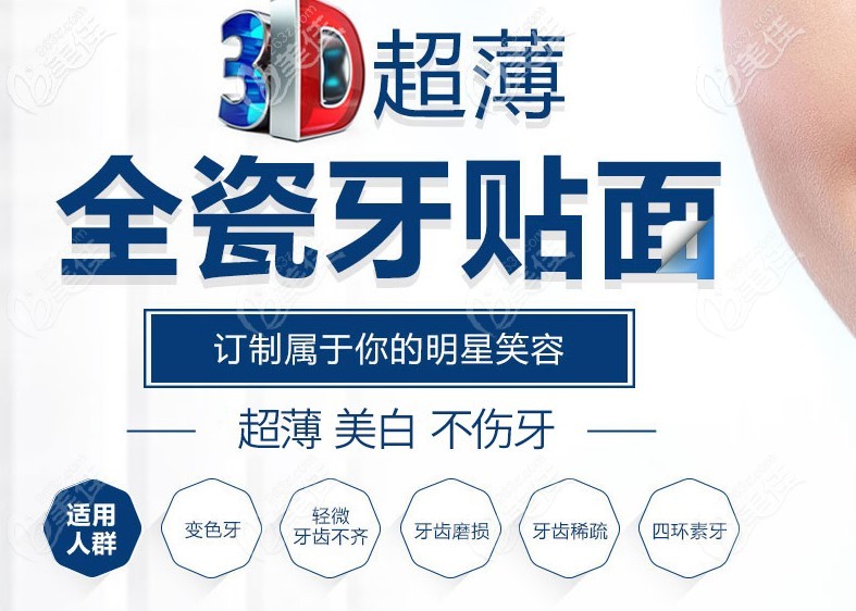 3D超薄全瓷牙贴面优势介绍 3D超薄全瓷牙贴面优势介绍