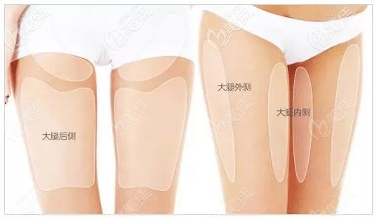 大腿抽脂的部位图解