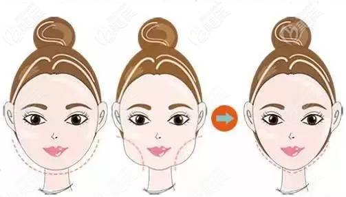 20210322_1616383064815618.png 1.png