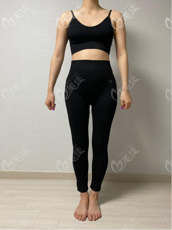 两个月的腿围大概是49CM