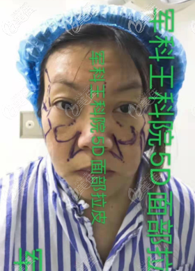 术前照片 术前照片