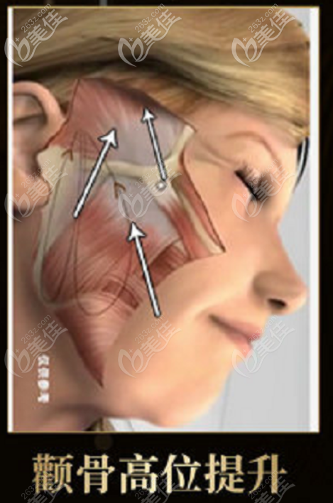 聂云飞医生拉皮手术做的好的优势点二 聂云飞医生拉皮手术做的好的优势点二