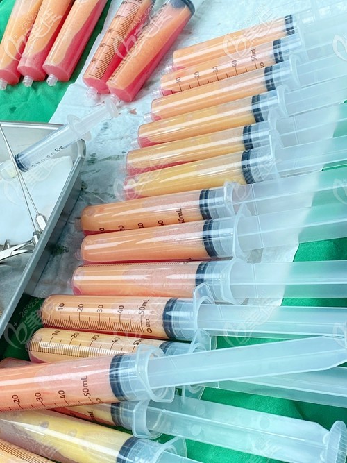 无限兰斯瘦大腿吸脂22管