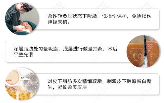 合肥艺星吸脂方式 合肥艺星吸脂方式