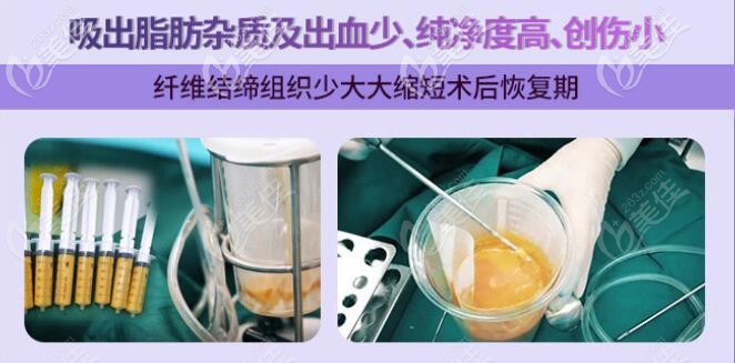 吸出的脂肪纯度更高