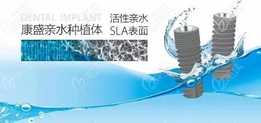 康盛亲水种植体的外观