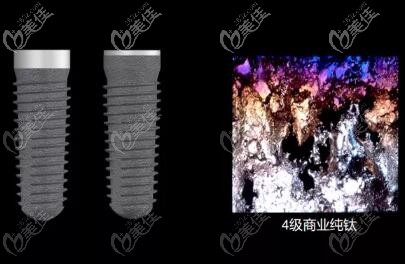 CAMLOG种植体材料 CAMLOG种植体材料