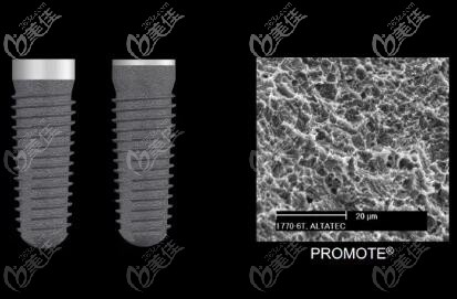 PROMOTE喷砂加酸蚀表面处理 PROMOTE喷砂加酸蚀表面处理