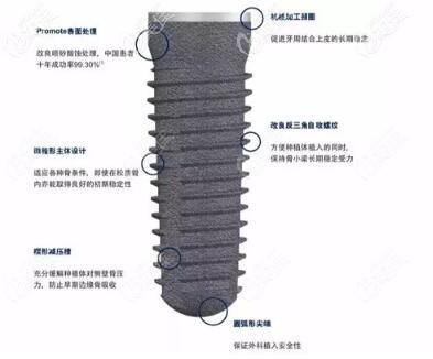 德国CAMLOG种植体优势 德国CAMLOG种植体优势