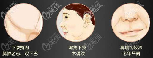 DM小切口动态记忆面部提升术相关适应症