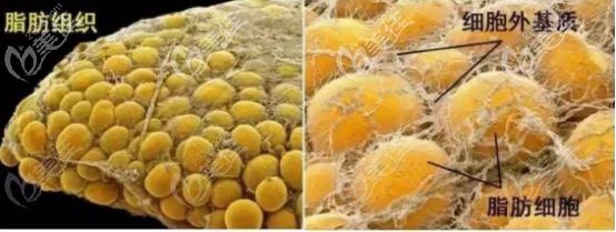 svf脂肪胶的制作原理