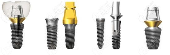 韩国dio种植体是什么材质