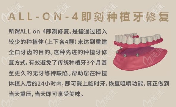 <!--<i data=20240703-sp></i>-->健皓口腔ALL-on-4即刻负重种植牙 <!--<i data=20240703-sp></i>-->健皓口腔ALL-on-4即刻负重种植牙