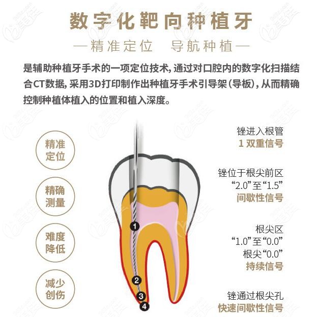 上海健皓口腔数字化靶 向种植牙