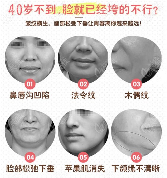 40岁后脸部松弛下垂的部位