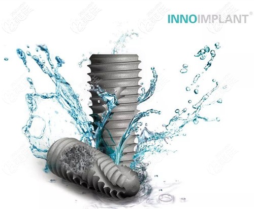 韩国伊诺种植体 韩国伊诺种植体