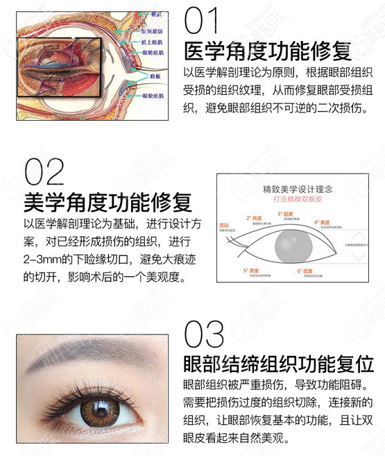 双眼皮早期可以修复吗？双眼皮失败1-2周内是可以修复的