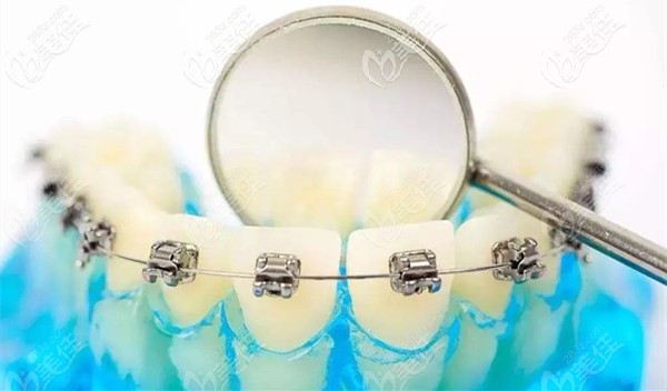 我国专业的正畸医生目前只有5千多人