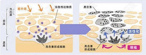 面部斑点产生的原因