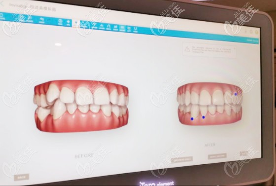 登特口腔的口扫结果