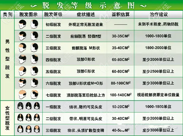 脱发面积等级图示 脱发面积等级图示