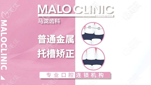 郑州马泷齿科牙齿矫正/正畸价格表