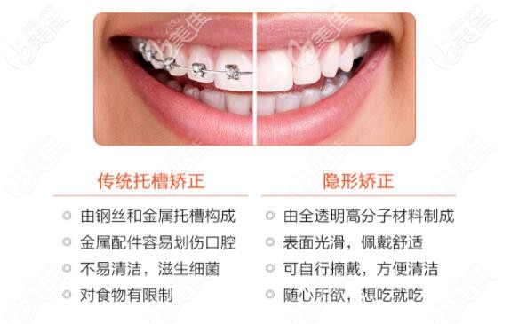 隐形矫正和传统矫正的区对比图 隐形矫正和传统矫正的区对比图