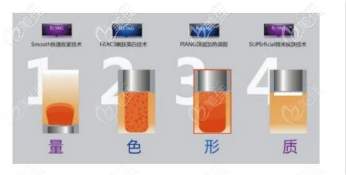欧洲之星fotona4d和fotona4dpro的区别