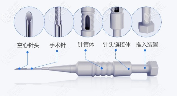 大麦微针植发技术原理 大麦微针植发技术原理