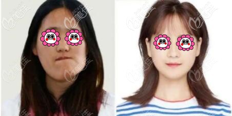 沈阳杏林颌面整形