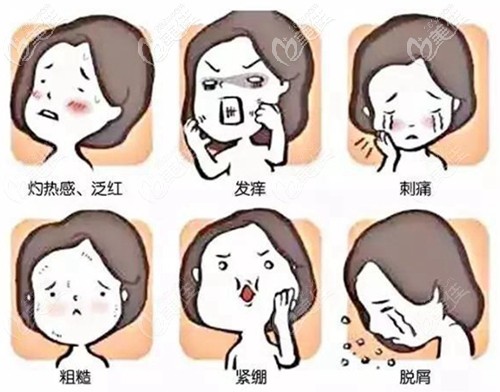 皮肤干燥出现过敏反应