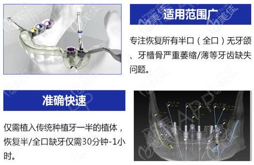 即刻负重适用广泛、方便快捷