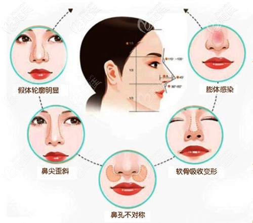 武汉美基元可以修复的鼻子类型