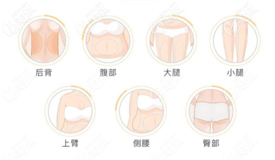 深圳全身吸脂手术多少钱 深圳全身吸脂手术多少钱