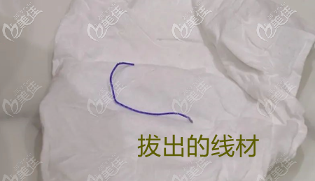 脱落的线材 脱落的线材