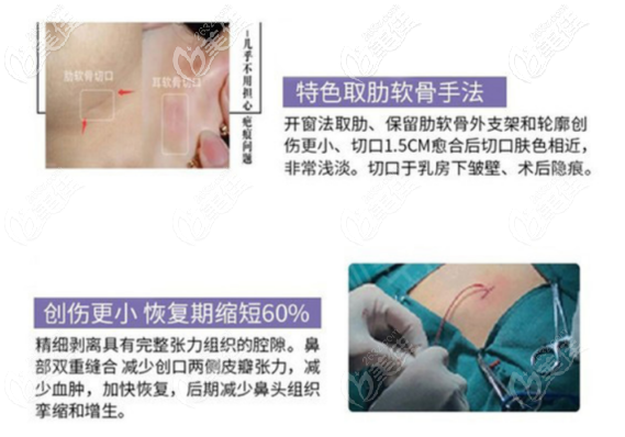 西安美莱做假体隆鼻的技术优势