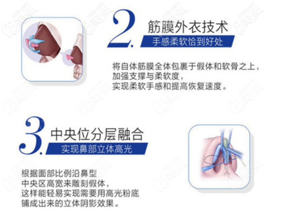 西安美莱做鼻子的技术优势