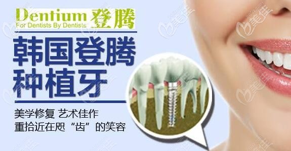 登腾种植牙性价比高
