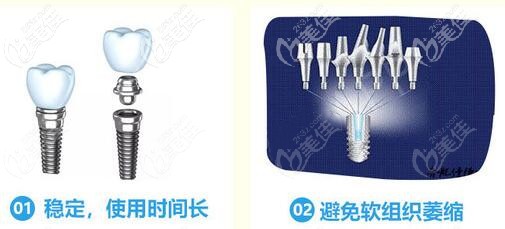 美国皓圣稳定性好，使用寿命更长久