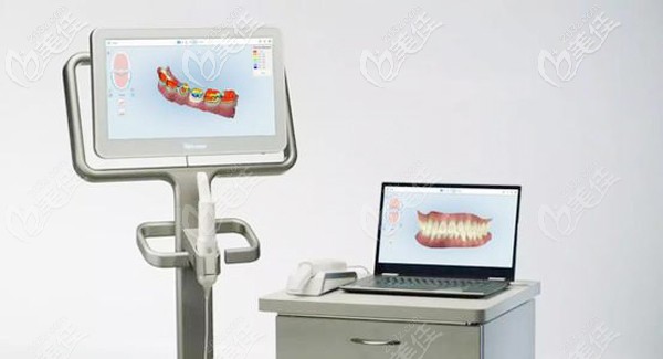 隐适美iTero口扫仪