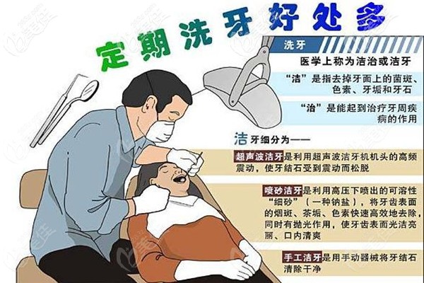 柳州蓝天洗牙费用