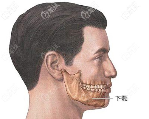 下颌角内收和外翻的区别