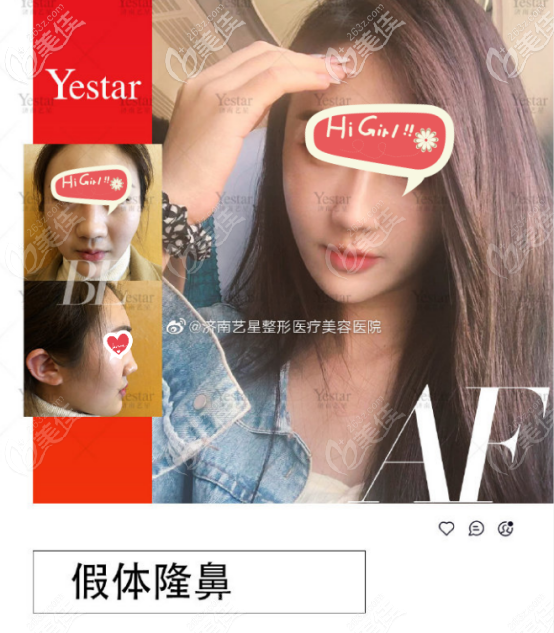 一号求美者案例图片以及真实评价 一号求美者案例图片以及真实评价