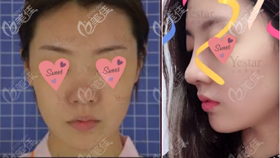 三号求美者案例图片以及真实评价 三号求美者案例图片以及真实评价