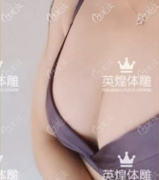 亲身体验项力源丰胸技术还蛮好的