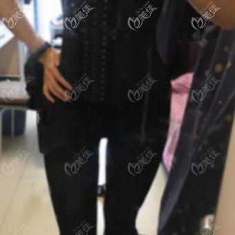 做威塑腰腹环吸术后痛感还是比较轻的 做威塑腰腹环吸术后痛感还是比较轻的