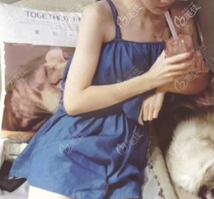 威塑腰腹环吸恢复期也不算太久,这是我两个多月的样子 威塑腰腹环吸恢复期也不算太久,这是我两个多月的样子