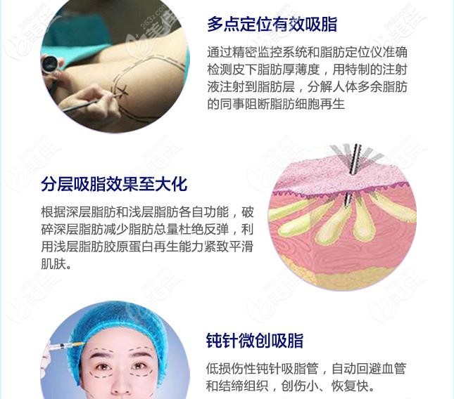 从技术优势了解太原时光吸脂怎么样