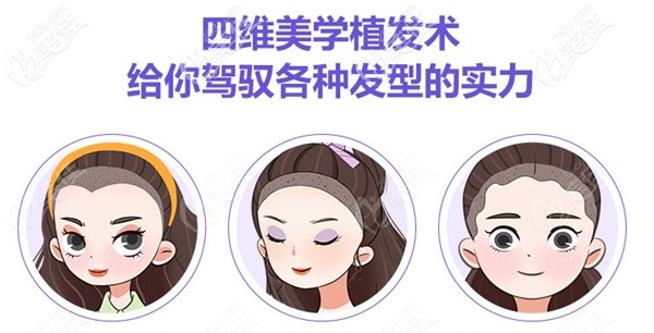 董海英擅长四维美学植发术 董海英擅长四维美学植发术