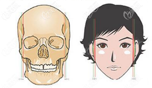 面部轮廓三件套手术指的是磨骨还是削骨